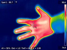 Thermographic Cameras Image of Human Hand